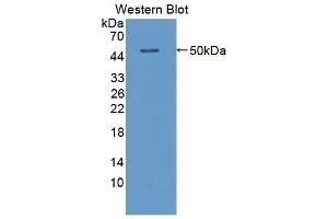 Detection of Recombinant ACY1, Human using Polyclonal Antibody to Aminoacylase 1 (ACY1) (Aminoacylase 1 anticorps  (AA 2-408))