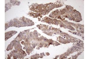 Immunohistochemistry (IHC) image for anti-Achalasia, Adrenocortical Insufficiency, Alacrimia (AAAS) (AA 322-546) antibody (ABIN2715861)