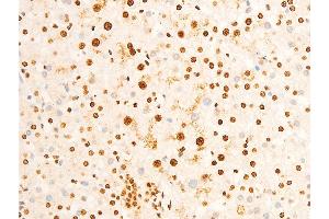 ABIN6267301 at 1/100 staining human lung tissue sections by IHC-P.