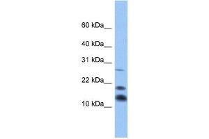 C1D antibody used at 0. (C1D anticorps  (Middle Region))