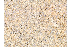 ABIN7094870 and ABIN7098922 at 1/100 staining Rat liver tissue by IHC-P. (Der1-Like Domain Family, Member 2 (DERL2) (C-Term) anticorps)