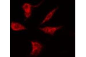 ABIN6275226 staining Hela by IF/ICC. (PGRMC2 anticorps  (C-Term))