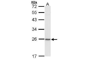 WB Image Sample (30 ug of whole cell lysate) A: Raji 12% SDS PAGE antibody diluted at 1:1000 (CBX1 anticorps  (Center))