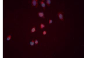 ABIN6276519 staining HeLa cells by ICC/IF. (CYR61 anticorps  (Internal Region))
