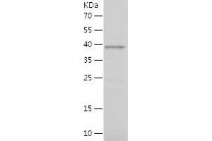 Western Blotting (WB) image for Chromosome 9 Open Reading Frame 72 (C9ORF72) (AA 1-198) protein (His-IF2DI Tag) (ABIN7122395)