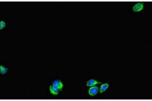 Immunofluorescent analysis of HepG2 cells using ABIN7175178 at dilution of 1:100 and Alexa Fluor 488-congugated AffiniPure Goat Anti-Rabbit IgG(H+L)