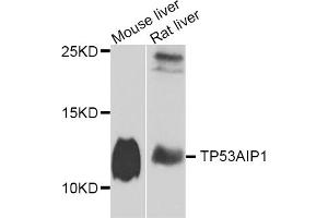 Western blot analysis of extracts of various cell lines, using TP53AIP1 antibody.