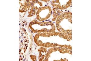 Immunohistochemical analysis of paraffin-embedded H.