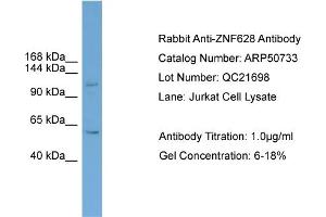 WB Suggested Anti-ZNF628  Antibody Titration: 0. (ZNF628 anticorps  (Middle Region))