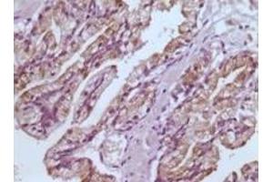 Immunohistochemistry (IHC) image for anti-Glutathione S-Transferase pi 1 (GSTP1) (truncated) antibody (ABIN2464062)