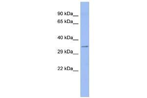 WB Suggested Anti-ASPH Antibody Titration:  0.