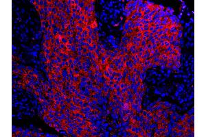 Immunofluorescence (IF) image for anti-Stratifin (SFN) (AA 198-248) antibody (ABIN7448925)