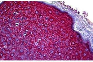 Human Skin: Formalin-Fixed, Paraffin-Embedded (FFPE) (CCR3 anticorps  (N-Term))