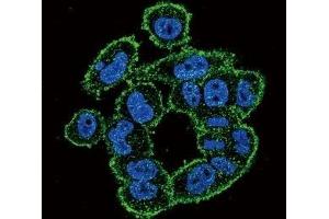 Confocal immunofluorescent analysis of UPA antibody with A2058 cells followed by Alexa Fluor 488-conjugated goat anti-rabbit lgG (green). (PLAU anticorps  (AA 396-426))