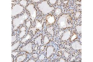 IHC analysis of SP1 using anti-SP1 antibody (ABIN7601559).