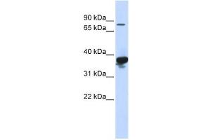 Western Blotting (WB) image for anti-LON Peptidase N-terminal Domain and Ring Finger 2 (LONRF2) antibody (ABIN2458756) (LONRF2 anticorps)