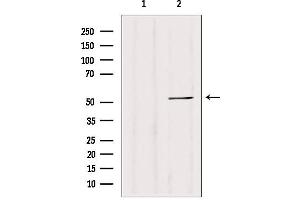Western blot analysis of extracts from 293, using CALCOCO2 antibody. (CALCOCO2 anticorps  (Internal Region))