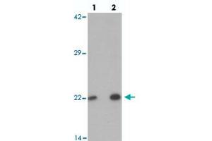 Western blot analysis of PHOX2B in 293 cell lysate with PHOX2B polyclonal antibody  at (lane 1) 1 and (lane 2) 2 ug/mL. (PHOX2B anticorps  (Internal Region))