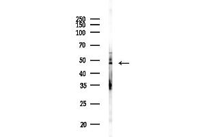 anti-PAK1 Interacting Protein 1 (PAK1IP1) (C-Term) antibody