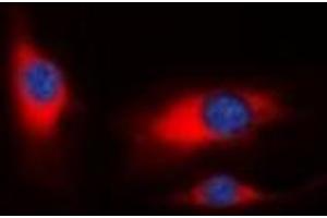 Immunofluorescent analysis of PAK1 staining in HeLa cells. (PAK1 anticorps)