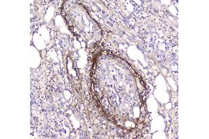 IHC analysis of Serum Amyloid P using anti-Serum Amyloid P antibody .
