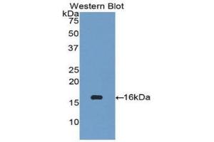 Western blot analysis of the recombinant protein. (CCL27 anticorps  (AA 25-112))
