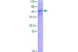Image no. 1 for Killer Cell Immunoglobulin-Like Receptor, Two Domains, Long Cytoplasmic Tail, 3 (KIR2DL3) (AA 1-341) protein (GST tag) (ABIN1308693)