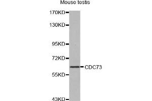anti-Parafibromin (CDC73) (AA 435-505) antibody