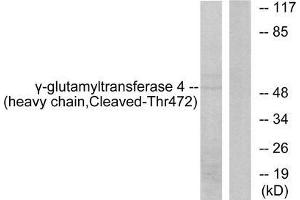 Western blot analysis of extracts from Jurkat cells, treated with etoposide (25uM, 24hours), using Gamma-glutamyltransferase 4 (heavy chain, Cleaved-Thr472) antibody. (GGT7 anticorps  (Internal Region))