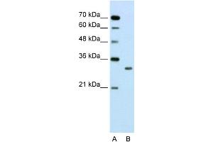 WB Suggested Anti-SBDS Antibody Titration:  2. (SBDS anticorps  (N-Term))