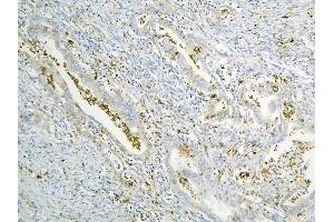 IHC analysis of ANXA3 using anti-ANXA3 antibody (ABIN6719269). (Annexin A3 anticorps  (AA 23-323))