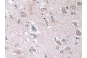 Detection of D2HGDH in Human Cerebrum Tissue using Polyclonal Antibody to D2-Hydroxyglutarate Dehydrogenase (D2HGDH)