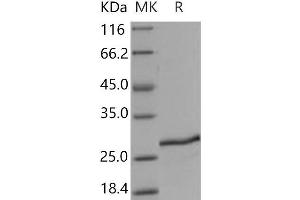 Western Blotting (WB) image for Stromal Cell Derived Factor 2 (SDF2) protein (His tag) (ABIN7320352) (SDF2 Protein (His tag))