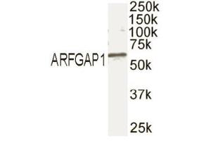 Western blot analysis of ARFGAP1 in mouse brain extract with ABIN121678.