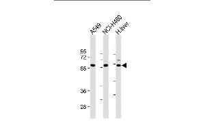 All lanes : Anti-Dsiglec-W20 at 1:2000 dilution Lane 1: A549 whole cell lysate Lane 2: NCI- whole cell lysate Lane 3: Human liver lysate Lysates/proteins at 20 μg per lane. (SIGLEC7 anticorps  (N-Term))