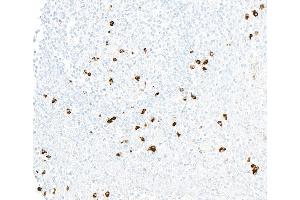 Immunohistochemistry (IHC) image for anti-Chemokine (C-X3-C Motif) Receptor 1 (CX3CR1) (AA 300-350) antibody (ABIN7795802) (Recombinant CX3CR1 anticorps  (AA 300-350))