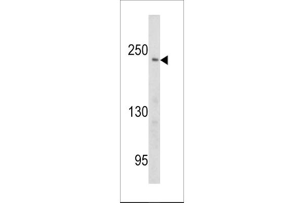 PCM1 anticorps  (AA 632-661)