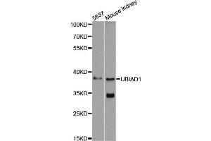 Western blot analysis of extracts of various cell lines, using UBIAD1 antibody (ABIN6293616) at 1:500 dilution.