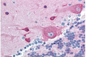 Human Brain, Cerebellum (formalin-fixed, paraffin-embedded) stained with PACSIN2 antibody ABIN293028 at 10 ug/ml followed by biotinylated goat anti-rabbit IgG secondary antibody ABIN481713, alkaline phosphatase-streptavidin and chromogen. (PACSIN2 anticorps  (AA 400-450))