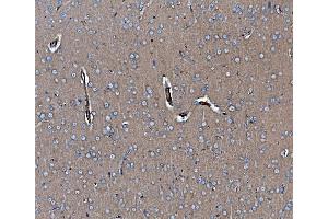 IHC analysis of EHD3 using anti-EHD3 antibody (ABIN7602777). (EHD3 anticorps  (C-Term))