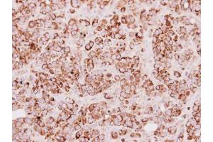 IHC-P Image Immunohistochemical analysis of paraffin-embedded MCF7 xenograft, using TST, antibody at 1:250 dilution.