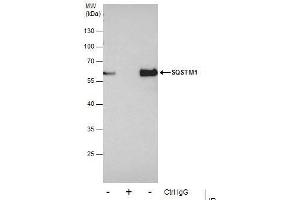 IP Image Immunoprecipitation of SQSTM1 protein from HeLa whole cell extracts using 5 μg of SQSTM1 antibody [N3C1], Internal, Western blot analysis was performed using SQSTM1 antibody [N3C1], Internal, EasyBlot anti-Rabbit IgG  was used as a secondary reagent.