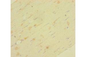Immunohistochemistry of paraffin-embedded human skeletal muscle tissue using ABIN7158146 at dilution of 1:100 (LRRC19 anticorps  (AA 25-270))