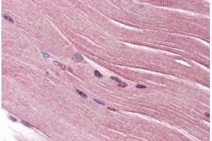 Human Skeletal Muscle (formalin-fixed, paraffin-embedded) stained with SH3GLB1 antibody ABIN334268 at 2. (SH3GLB1 anticorps)