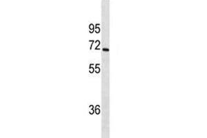 CYP1A2 antibody western blot analysis in SK-BR-3 lysate.
