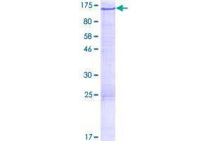 Image no. 1 for ALS2 C-terminal Like (ALS2CL) (AA 1-953) protein (GST tag) (ABIN1344950)