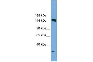 WB Suggested Anti-EEA1 Antibody Titration: 0. (EEA1 anticorps  (N-Term))