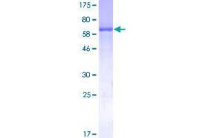 Image no. 1 for Alcohol Dehydrogenase 4 (Class II), pi Polypeptide (ADH4) (AA 1-380) protein (GST tag) (ABIN1305983)