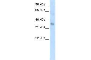 WB Suggested Anti-TGFB1 Antibody Titration:  0.