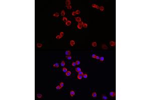 Immunofluorescence analysis of Neuro-2a cells using TrkB Rabbit pAb (ABIN3022911, ABIN3022912, ABIN3022913 and ABIN6219292) at dilution of 1:150 (40x lens).